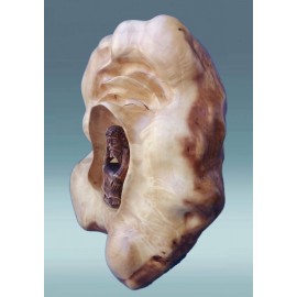 Medinis rūpintojėlis