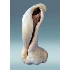 Medinio penio skultūra