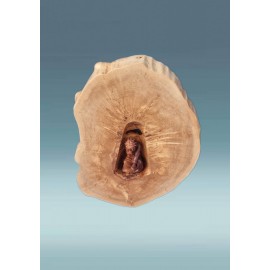 Medinis rūpintojėlis